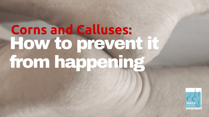 Corn and Callus Prevention - Walk This Way Healthcare