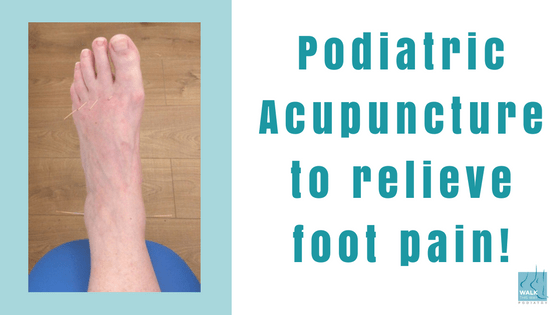 Podiatric Acupuncture to relieve foot pain